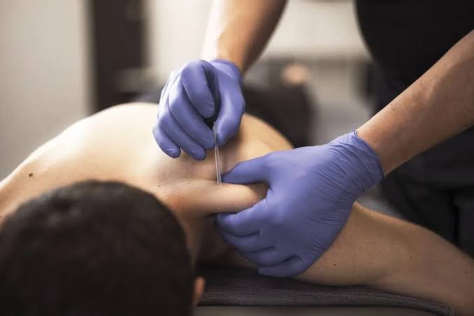 Terapia Invasiva Mínima